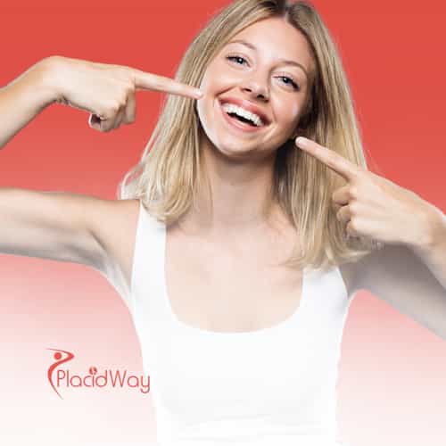 Carillas dentales en Los Algodones, México: Tratamiento asequible para californianos